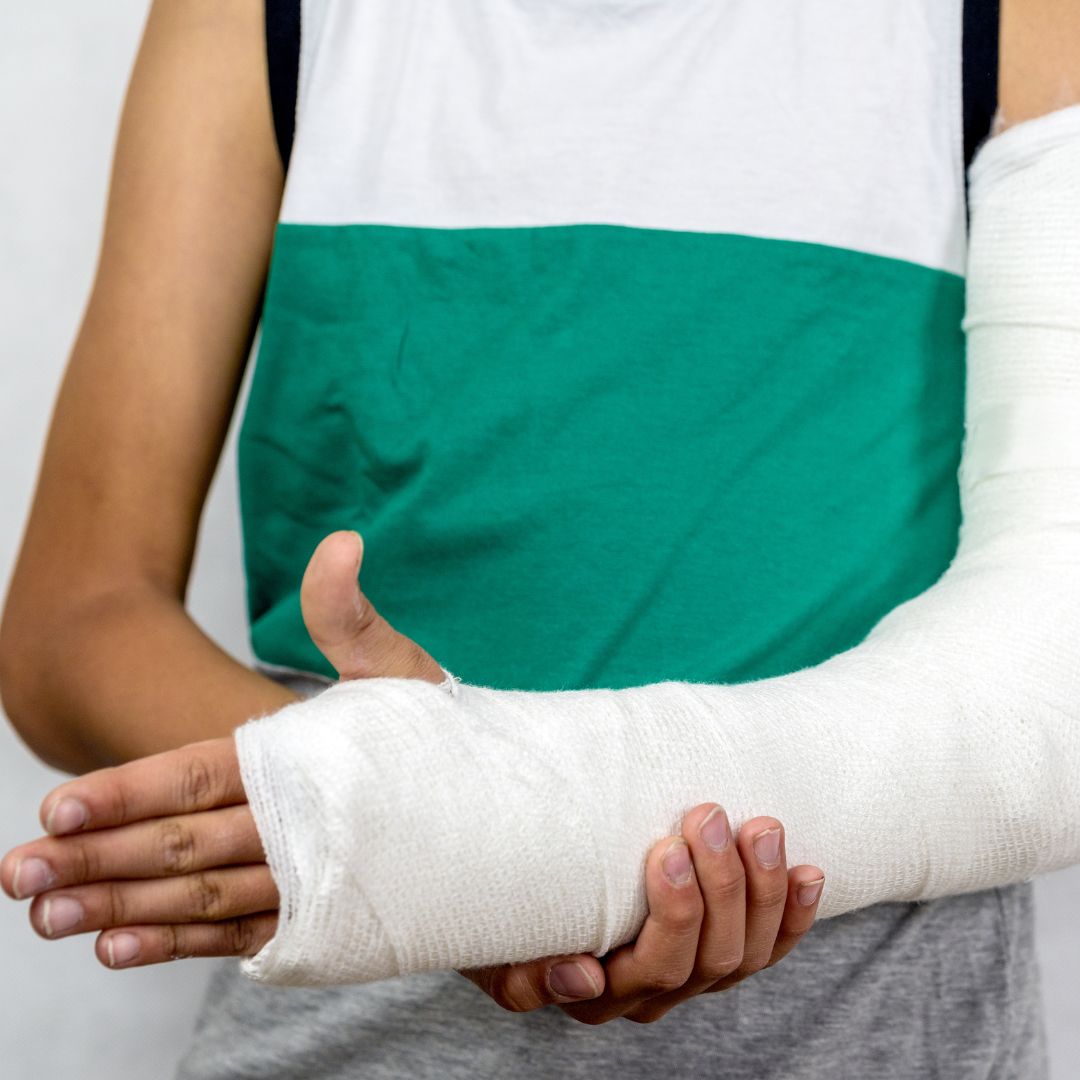 Broken Arm